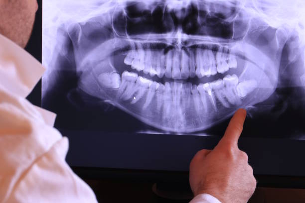 Best Emergency Root Canal Treatment in Brooklyn, WI