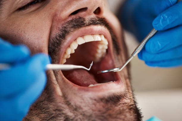 Best Emergency Tooth Extraction in Brooklyn, WI